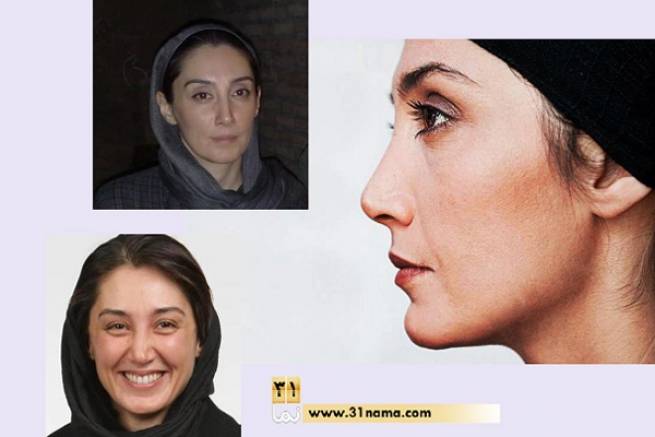 هدیه تهرانی و بایکوت خودآرائی / ده عکس از هدیه تهرانی این سالهای بدون آرایش
