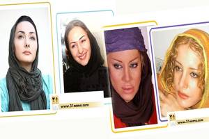 تغییر چهره / نقش جراحی پلاستیک در موفقیت بازیگران زن ایرانی